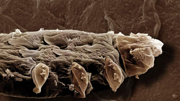 Биологи обнаружили анусы у клещей, спаривающихся на лице человека