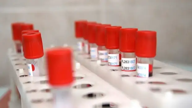 В лабораториях Ставрополья провели свыше 1,4 млн тестов на COVID-19