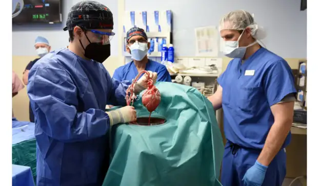 Умер первый пациент, которому пересадили сердце свиньи