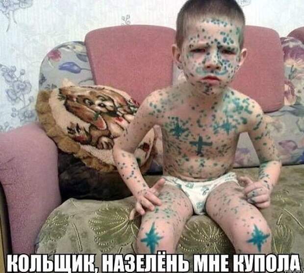 Когда ветрянку лечит папа ветрянка, дети, настроение