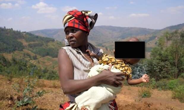 Родственники отказались от африканки, которая родила малыша с головой в форме груши
