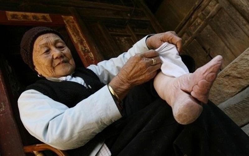Да, красота требует жертв, но такое уму непостижимо: ноги китайских «женщин-лотосов» Да, красота требует жертв, но такое уму непостижимо: ноги китайских «женщин-лотосов»