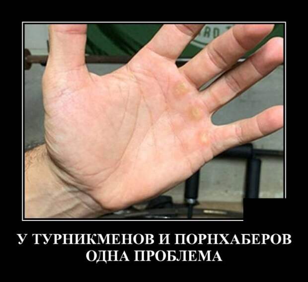 Демотиватор про мозоли