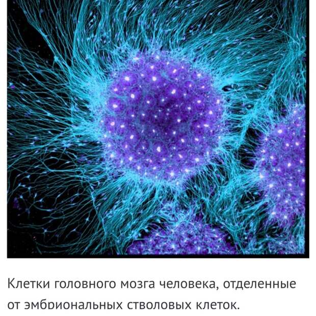 Невероятные фотографии под микроскопом Микроскоп, Макросъемка, Интересное, Длиннопост