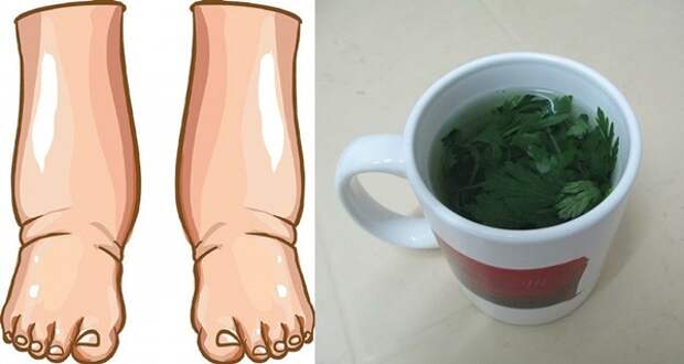 the-most-powerful-natural-remedy-for-swollen-legs