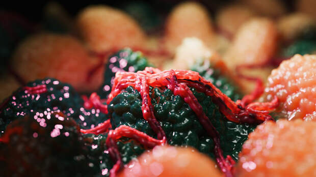 Врач Черёмушкин: онковакцина рассчитана на лечение трёх видов рака