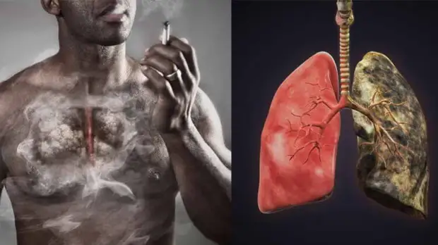 Восстанавливаются ли клетки легких после того, как человек бросил курить?