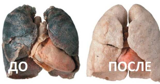 1476291377_smoker-and-healthy-lungs1-copy