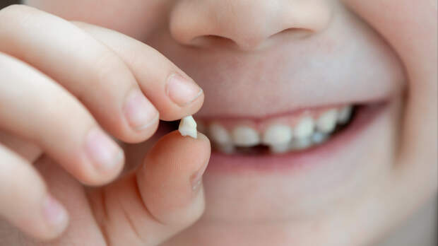 Как без боли вырвать молочный зуб у ребенка: чек-лист для родителей