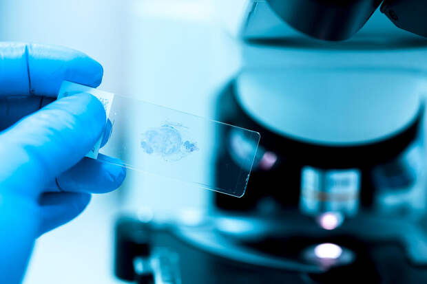 AnChem: удаление белка CHK1 из раковых клеток запускает их самоуничтожение