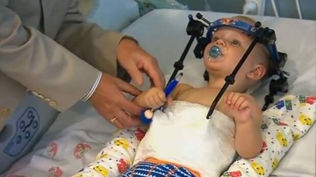 Настоящее чудо: медики спасли малыша, которому оторвало голову в ДТП. Австралия, дети и подростки, ДТП, медицина, наука и открытия. НТВ.Ru: новости, видео, программы телеканала НТВ