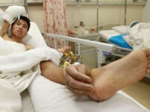 Сяо Вэй на больничной койке. Кадр телеканала Sky News