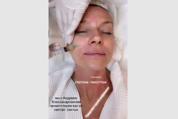 47-летняя Любовь Толкалина сделала уколы красоты на камеру