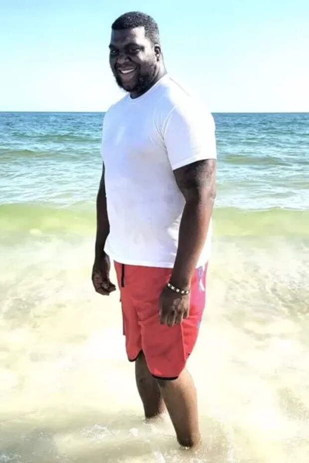 В США мужчине ампутировали руки и ноги после визита к стоматологу