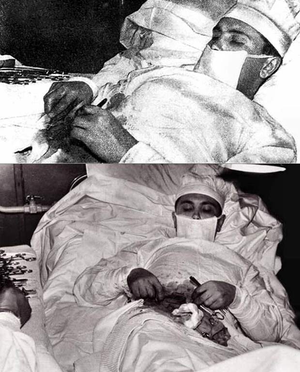 Leonid Rogozov removing his own appendix at a Soviet research station in Antarctica; ca. 1961.jpg