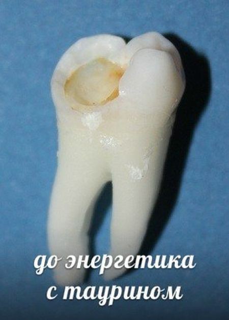 Десятка самых вредных напитков для ваших зубов Десятка самых вредных напитков для ваших зубов прикол, факты