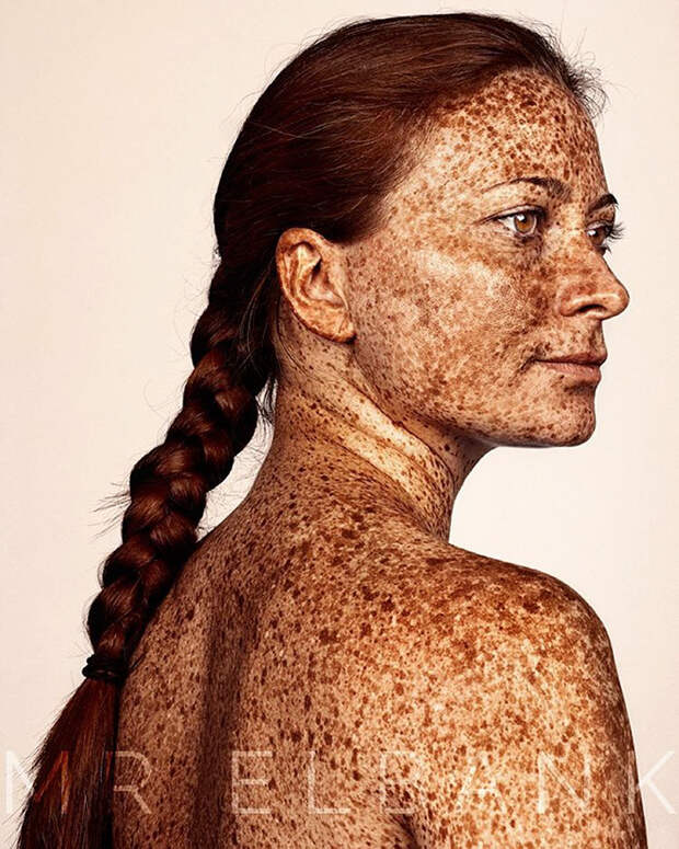 freckles-portrait-photography-brock-elbank-145__700