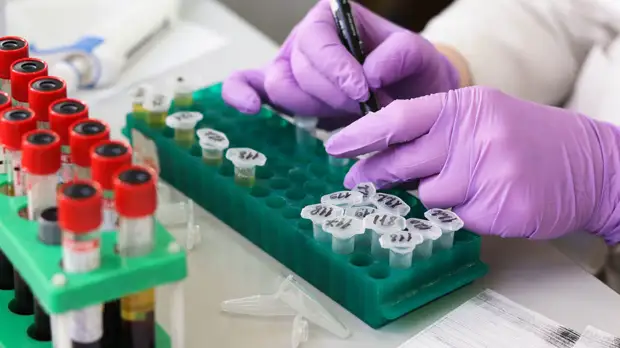 Под Вологдой подтверждены два первых случая заражения коронавирусом