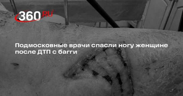 Женщину с опасными травмами ноги после ДТП спасли в больнице в Рузе