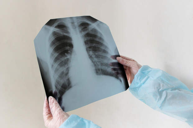 "Mash на Мойке": у преподавателя СПбГУ нашли туберкулез