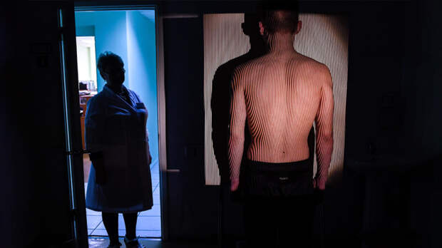 В Перми разработали метод диагностики сколиоза с помощью ИИ и смартфона