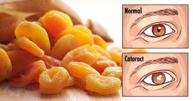 start-eating-26-foods-moment-notice-vision-getting-worse