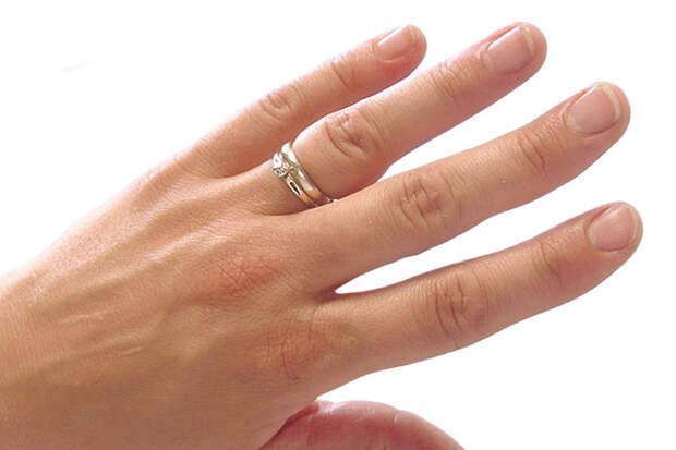 JAMA Dermatology: изменения в ногтях могут указывать на риск рака