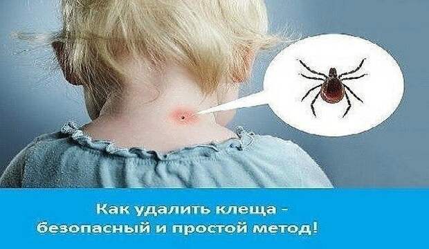 image (5)