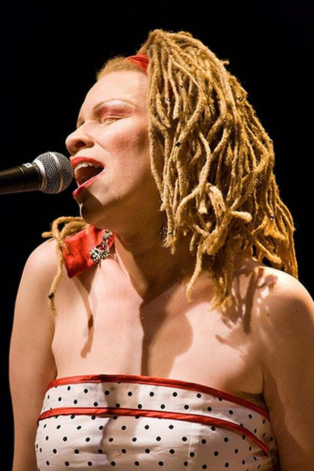 albinism-singer-mem-nahadr-610x915