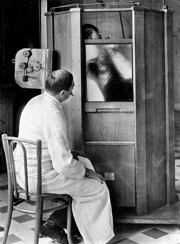 Рентген грудной клетки, Париж, 1914 первые, ренген, фото