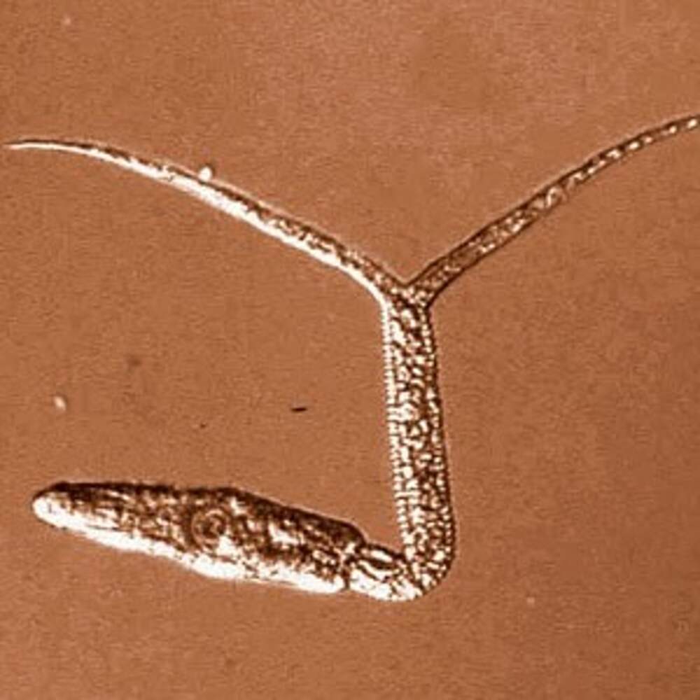 Плоские паразиты. Diplostomum spathaceum. Диплостомоз рыб возбудитель. Diplostomum spathaceum цикл. Рыбные паразиты под микроскопом.