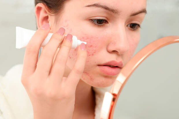 Врач Кондрахина: восстановить кожу можно с помощью полноценного сна и увлажнения