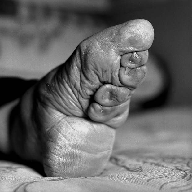 lastfootbinding05 Последние живые китаянки с лотосными ножками
