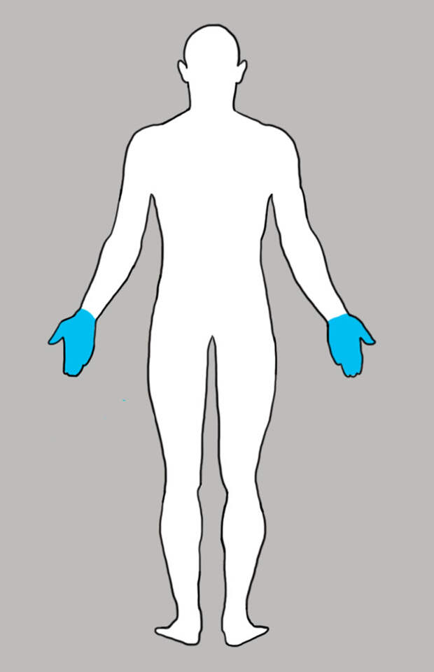 o-chem-govorit-bol-v-vashem-tele_09da65eaaa6deac2f785df1e0ae95a06