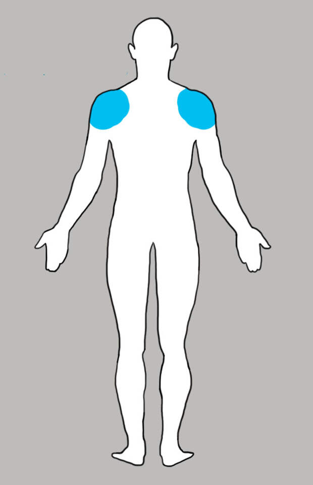 o-chem-govorit-bol-v-vashem-tele_b5dc235f61db748cba8f6dc3e7ea7b32