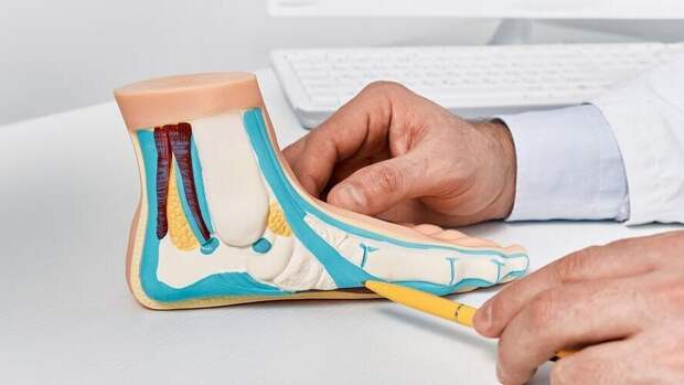 Всё о плоскостопии: болезнь или просто особенность строения стопы?