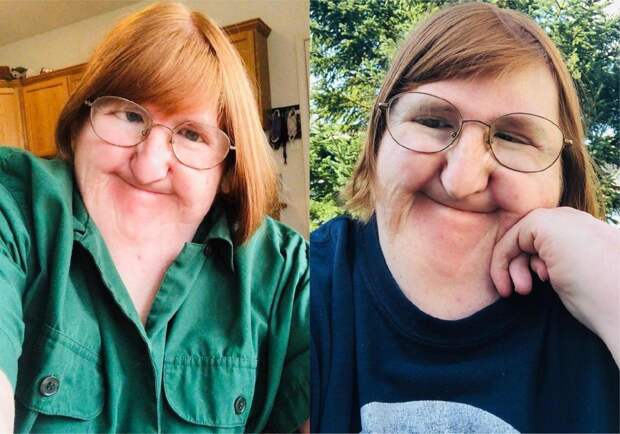 Фото © Instagram / melissablake81