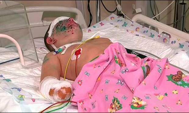 Ваня Воронов, поправляется после ранения в Донецке Ваня Воронов, раненый в Донецке поправляется