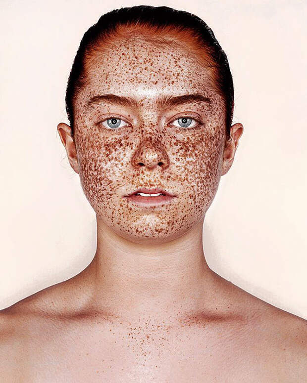 freckles-portrait-photography-brock-elbank-114__700