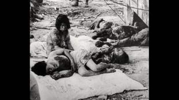 Раненые жители Хиросимы, 1945. 