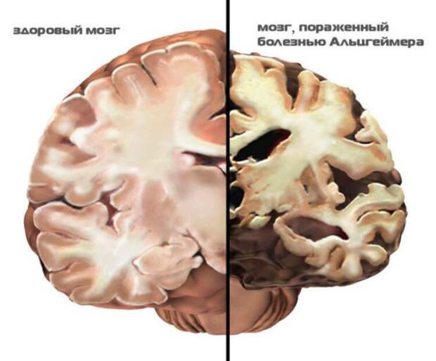 Почему же опасно спать днём