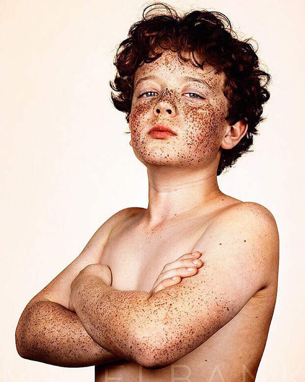 freckles-portrait-photography-brock-elbank-150__700