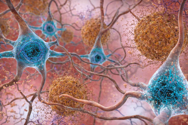 Учёные выяснили, почему Альцгеймер может протекать без симптомов