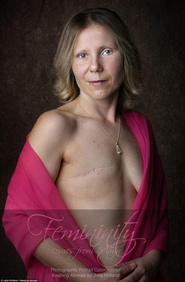Рак груди