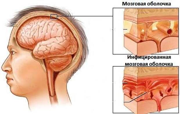 lechenie-simptomy.ru