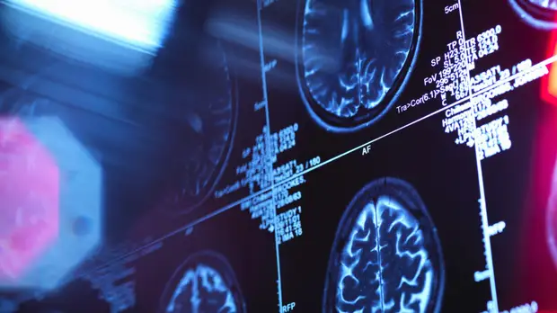 Невролог Соков рассказал о профилактике возникновения когнитивных нарушений