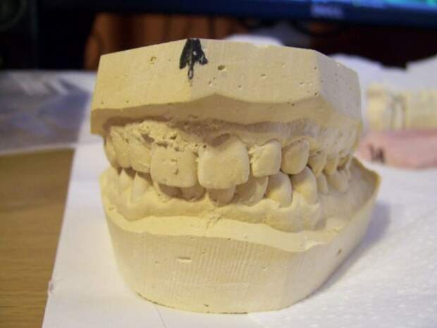 ТОП-25: Удивительные факты о зубах, которые являются правдой