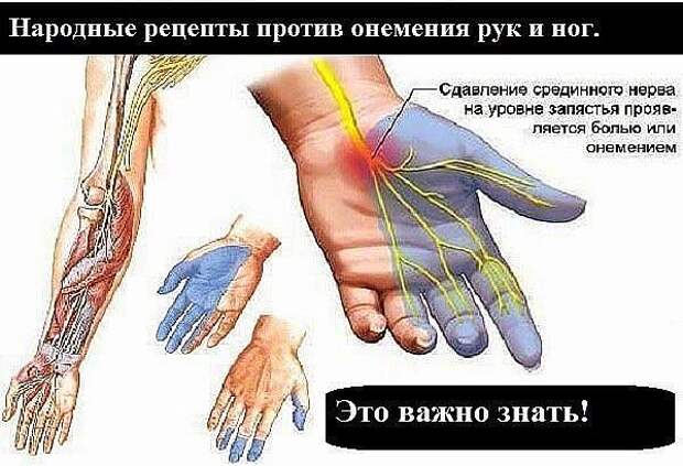 Онемения после анестезии. Онемели конечности рук и ног. Немеют руки.