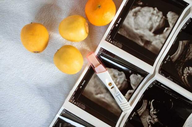 В Канаде у беременной женщины обнаружили эмбриона в печени