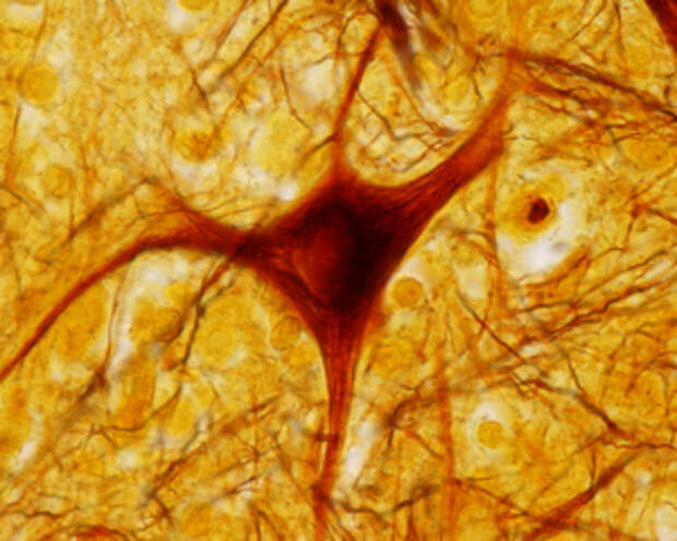 brain-aging-stem-cells-study-3